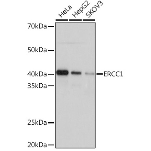 ERCC1 Rabbit mAb