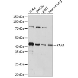 PAR4 Rabbit mAb