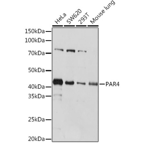 PAR4 Rabbit mAb