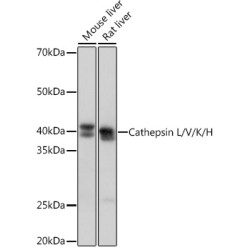 Cathepsin L/V/K/H Rabbit mAb