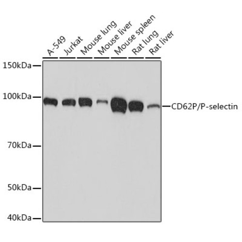 CD62P/P-selectin Rabbit mAb