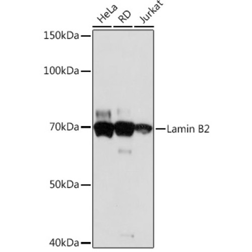 Lamin B2 Rabbit mAb