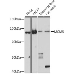 MCM5 Rabbit mAb