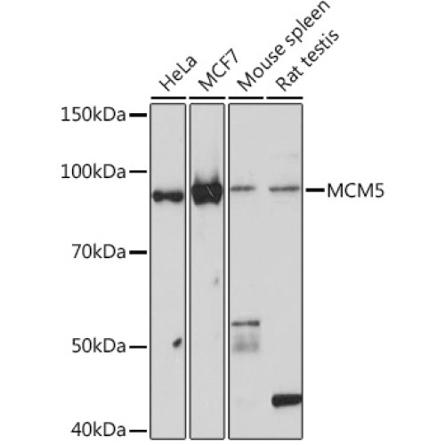 MCM5 Rabbit mAb