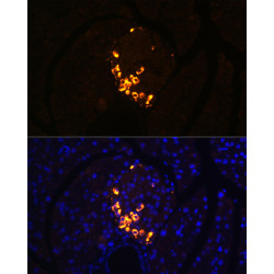 GLP-2 Rabbit mAb
