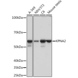 KPNA2 Rabbit mAb