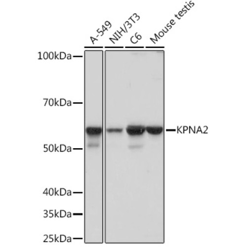 KPNA2 Rabbit mAb