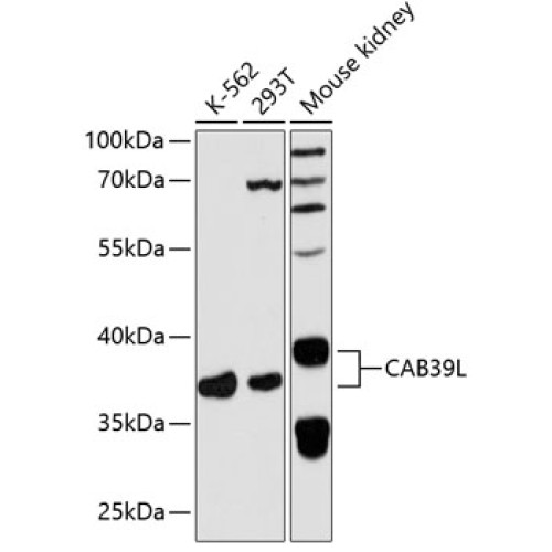 CAB39L Rabbit pAb