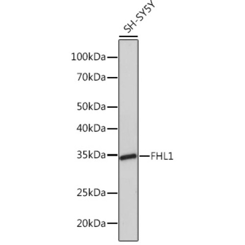 FHL1 Rabbit mAb