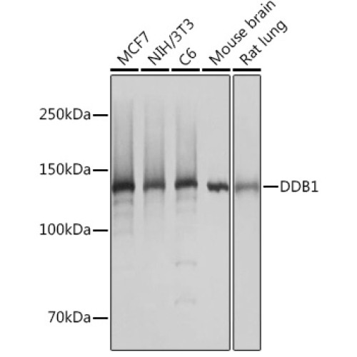 DDB1 Rabbit mAb