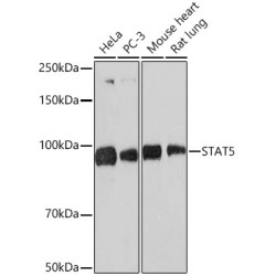 STAT5 Rabbit mAb