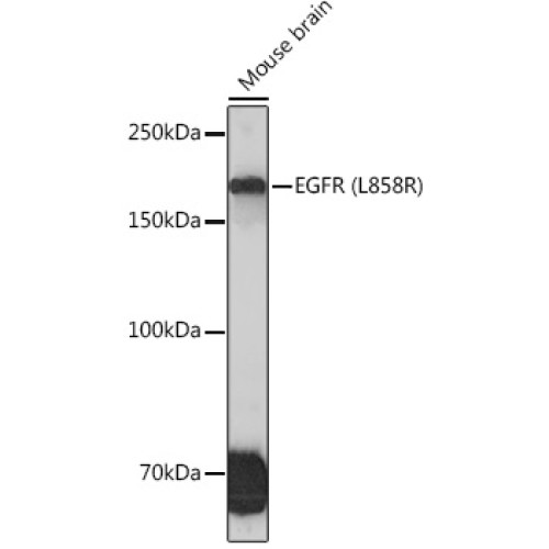 EGFR (L858R) Rabbit mAb