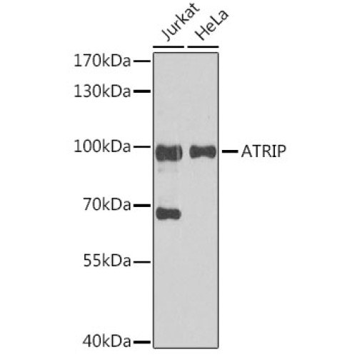 ATRIP Rabbit pAb
