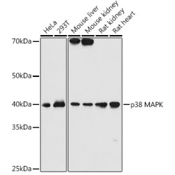 p38 MAPK Rabbit mAb