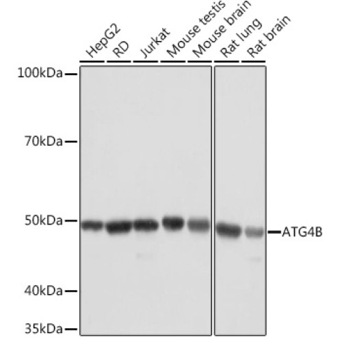 ATG4B Rabbit mAb