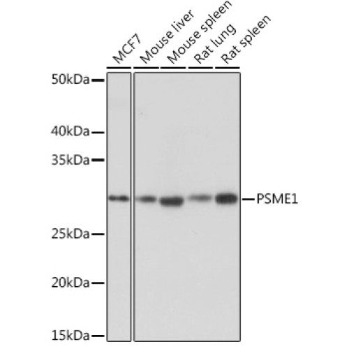 PSME1 Rabbit mAb