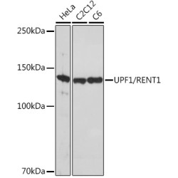 UPF1/RENT1 Rabbit mAb