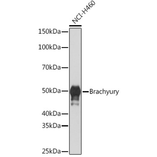 Brachyury Rabbit mAb