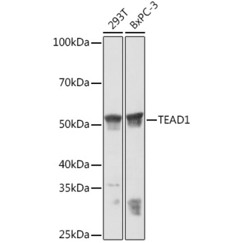 TEAD1/2/3/4 Rabbit mAb