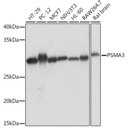PSMA3 Rabbit mAb