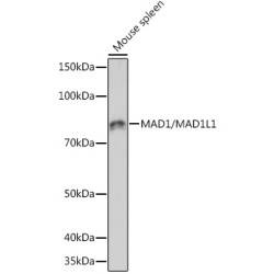 MAD1/MAD1L1 Rabbit mAb