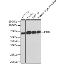 PAR2 Rabbit mAb