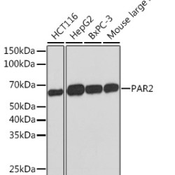 PAR2 Rabbit mAb