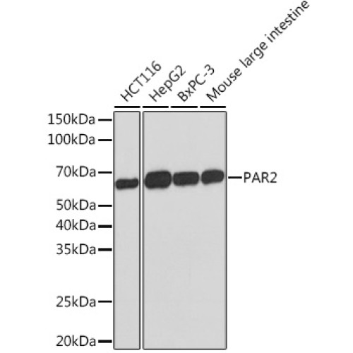 PAR2 Rabbit mAb