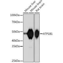 ATP1B1 Rabbit mAb