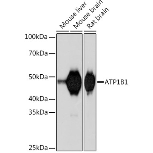 ATP1B1 Rabbit mAb