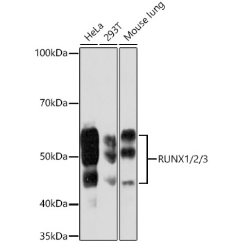 RUNX1/2/3 Rabbit mAb