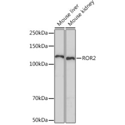 ROR2 Rabbit mAb