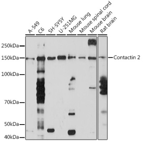 Contactin 2 Rabbit mAb