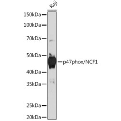 p47phox/NCF1 Rabbit mAb