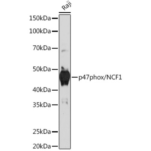 p47phox/NCF1 Rabbit mAb
