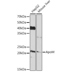 ApoM Rabbit mAb