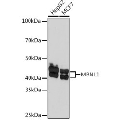 MBNL1 Rabbit mAb