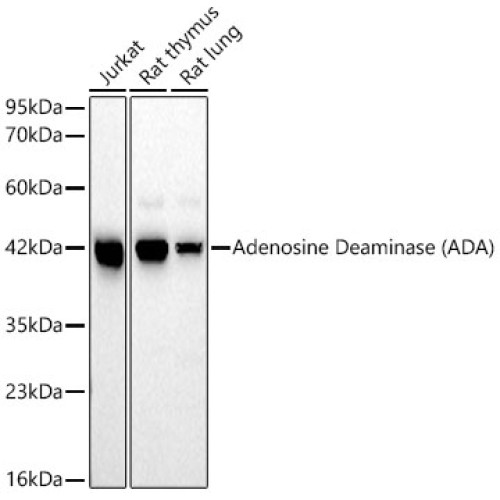 Adenosine Deaminase (ADA) Rabbit mAb