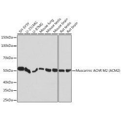 Muscarinic AChR M2 (ACM2) Rabbit mAb