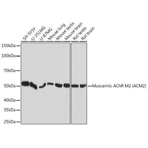 Muscarinic AChR M2 (ACM2) Rabbit mAb