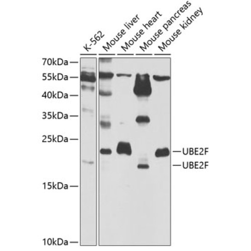 UBE2F Rabbit pAb