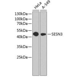SESN3 Rabbit pAb