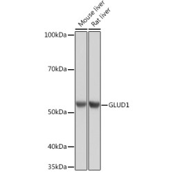 GLUD1 Rabbit mAb