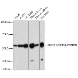 RUVBL1/TIP49A/PONTIN Rabbit mAb