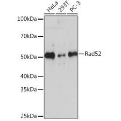 Rad52 Rabbit mAb