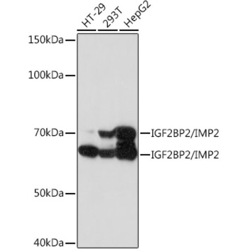 IGF2BP2/IMP2 Rabbit mAb