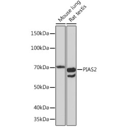 PIAS2 Rabbit mAb