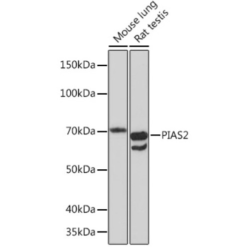 PIAS2 Rabbit mAb