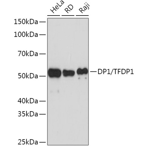 DP1/TFDP1 Rabbit mAb