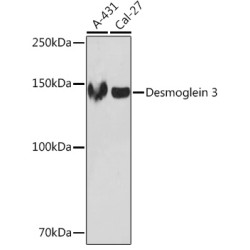 Desmoglein 3 Rabbit mAb